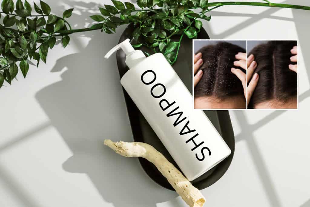  vegan anti-dandruff shampoo